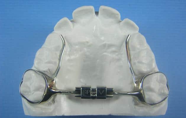 Orthodontic retainers